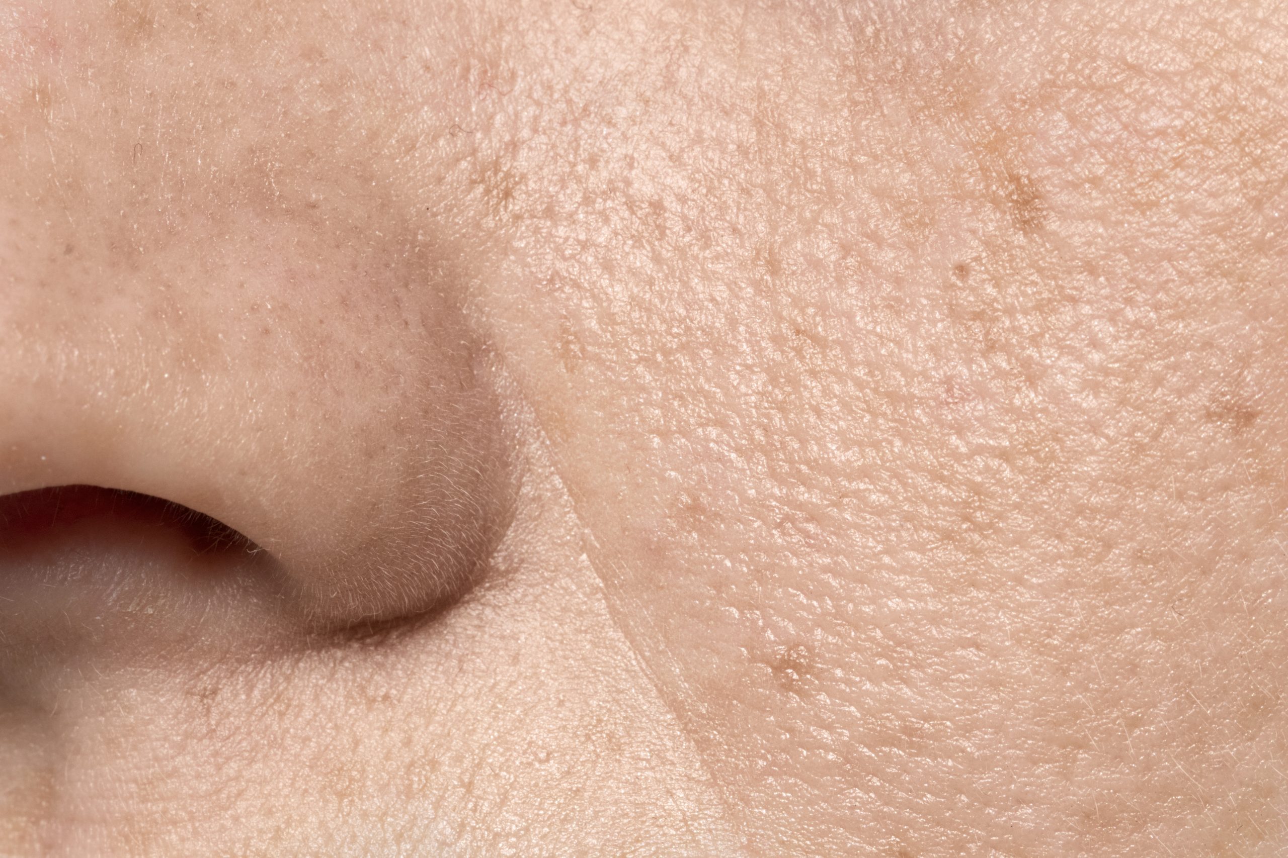 Pore Clogging Ingredients Oceren Skin Care Spa Orange County Pore Clogging Ingredients Oceren Skin Care Spa Orange County
